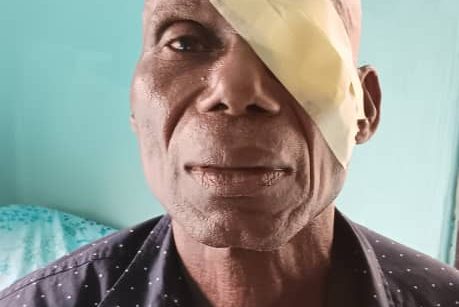 Eye Surgical Operation